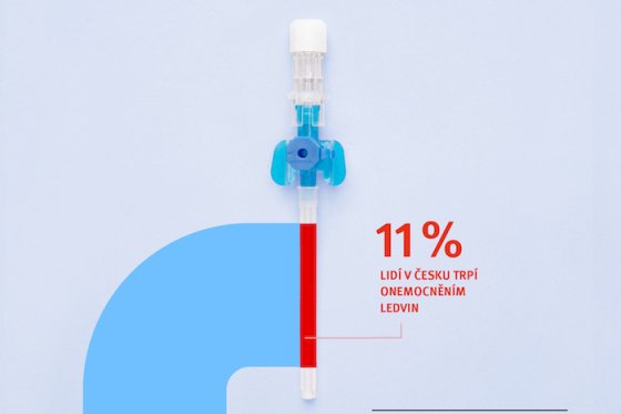 /media/21942/vzp_pre-kv-ledviny_slider